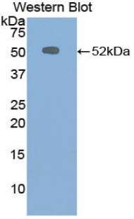 1 - Polyclonal Antibody to Chromogranin B (CHGB) AP74661