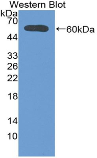1 - Polyclonal Antibody to Deiodinase, Iodothyronine, Type II (DIO2) AP74704