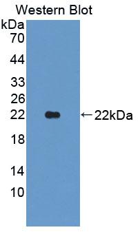 1 - Polyclonal Antibody to Lipocalin 11 (LCN11) AP74771