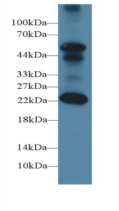 1 - Polyclonal Antibody to Follicle Stimulating Hormone Beta (FSHb) AP74787