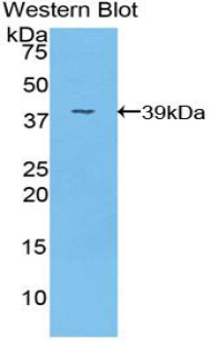1 - Polyclonal Antibody to Fibrinogen Like Protein 1 (FGL1) AP74643