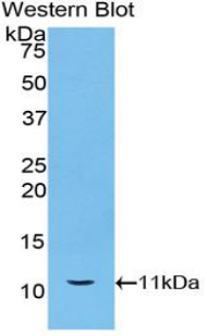 1 - Polyclonal Antibody to Heat Shock 70kDa Protein 8 (HSPA8) AP74630
