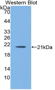 1 - Polyclonal Antibody to Hemoglobin Alpha 1 (HBa1) AP74644