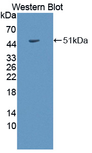 1 - Polyclonal Antibody to Collagen Type II Alpha 1 (COL2a1) AP74735