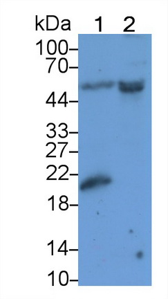 1 - Polyclonal Antibody to Sjogren Syndrome Antigen B (SSB) AP74705