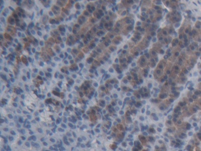 2 - Polyclonal Antibody to ATP Binding Cassette Transporter C11 (ABCC11) AP74802