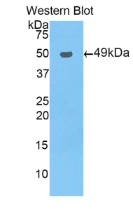1 - Polyclonal Antibody to Pregnane X Receptor (PXR) AP74618