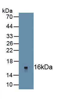 1 - Polyclonal Antibody to Nerve Growth Factor IB (NGFIB) AP74619