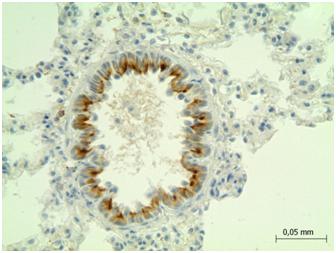 2 - Polyclonal Antibody to Adrenergic Receptor Beta 2 (ADRb2) AP74799