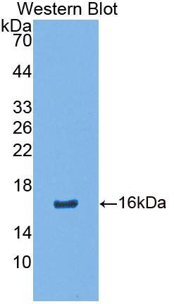 1 - Polyclonal Antibody to Calcium Binding Protein 2 (CABP2) AP74776
