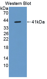 1 - Polyclonal Antibody to Defensin Alpha 6, Paneth Cell Specific (DEFa6) AP74620