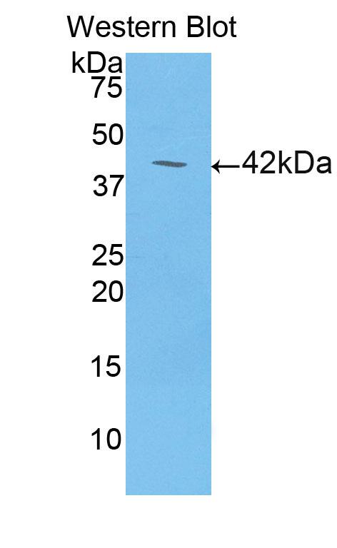 1 - Polyclonal Antibody to Lipocalin 6 (LCN6) AP74669