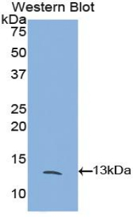 1 - Polyclonal Antibody to FK506 Binding Protein 1A (FKBP1A) AP74718