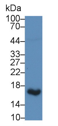 1 - Polyclonal Antibody to Uroplakin 2 (UPK2) AP74788