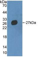 1 - Polyclonal Antibody to Multimerin 2 (MMRN2) AP74621
