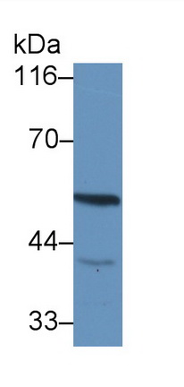 1 - Polyclonal Antibody to Dual Specificity Phosphatase 5 (DUSP5) AP74622
