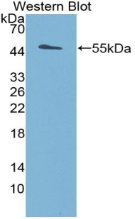 1 - Polyclonal Antibody to Deiodinase, Iodothyronine, Type III (DIO3) AP74623