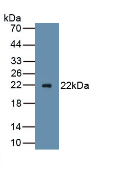 1 - Polyclonal Antibody to Advillin (AVIL) AP74781
