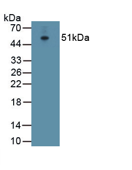 1 - Polyclonal Antibody to ATPase, Na+/K+ Transporting Alpha 1 Polypeptide (ATP1a1) AP74726