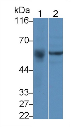 1 - Polyclonal Antibody to UDP Glucuronosyltransferase 2 Family, Polypeptide B7 (UGT2B7) AP74708