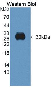 1 - Polyclonal Antibody to Retbindin (RTBDN) AP74762