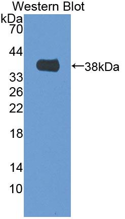1 - Polyclonal Antibody to Mitochondrial Methionyl tRNA Formyltransferase (MTFMT) AP74709