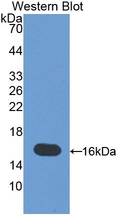 1 - Polyclonal Antibody to Melanoma Inhibitory Activity Protein 1 (MIA1) AP74710