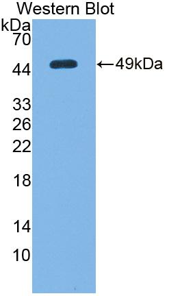 1 - Polyclonal Antibody to DNA Damage Inducible Transcript 3 (DDIT3) AP74711