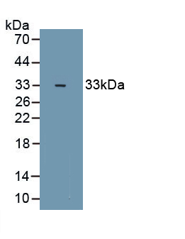 1 - Polyclonal Antibody to Zinc Finger Homeobox Protein 1B (ZFHX1B) AP74624