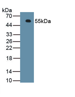 1 - Polyclonal Antibody to Fragile X Mental Retardation Syndrome Related Protein 1 (FXR1) AP74778