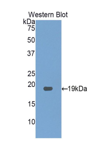 1 - Polyclonal Antibody to Gastrokine 3 (GKN3) AP74678