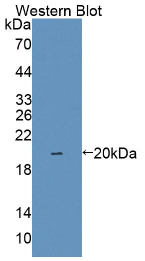 1 - Polyclonal Antibody to Interleukin 1 Family, Member 9 (IL1F9) AP74769