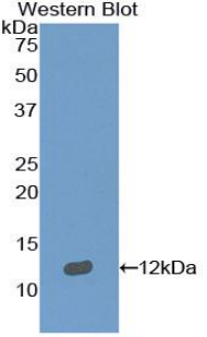 1 - Polyclonal Antibody to Semaphorin 3E (SEMA3E) AP74687