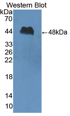 1 - Polyclonal Antibody to Peptidase Inhibitor 16 (PI16) AP74736