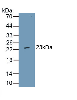 1 - Polyclonal Antibody to Von Willebrand Factor A Domain Containing Protein 5B2 (vWA5B2) AP74775