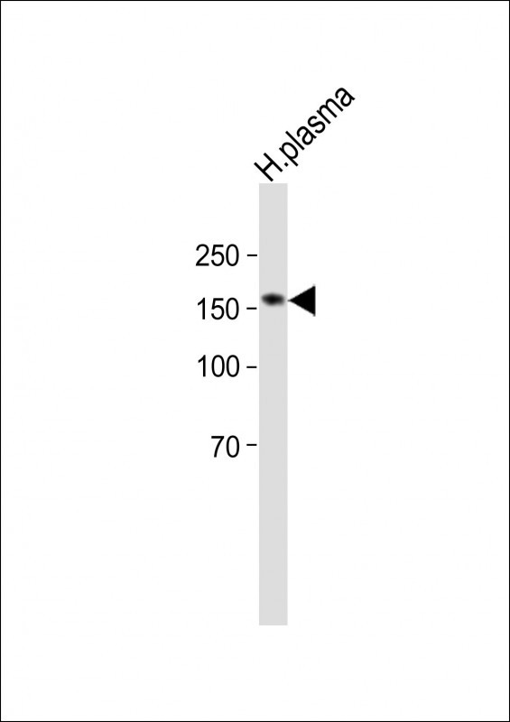 1 - DDX60L Antibody (C-term) AP11593b