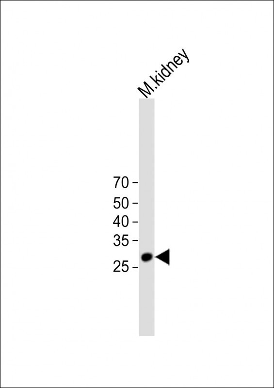1 - AK4 Antibody (Center) AP20571a