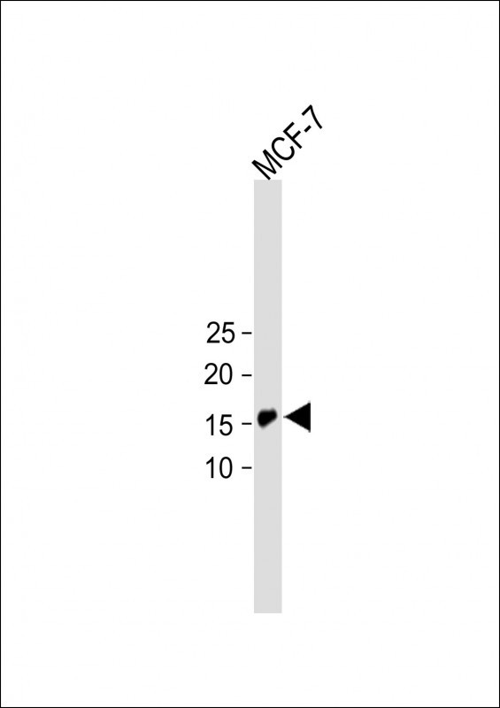 1 - C4orf32 Antibody (Center) AP5870c