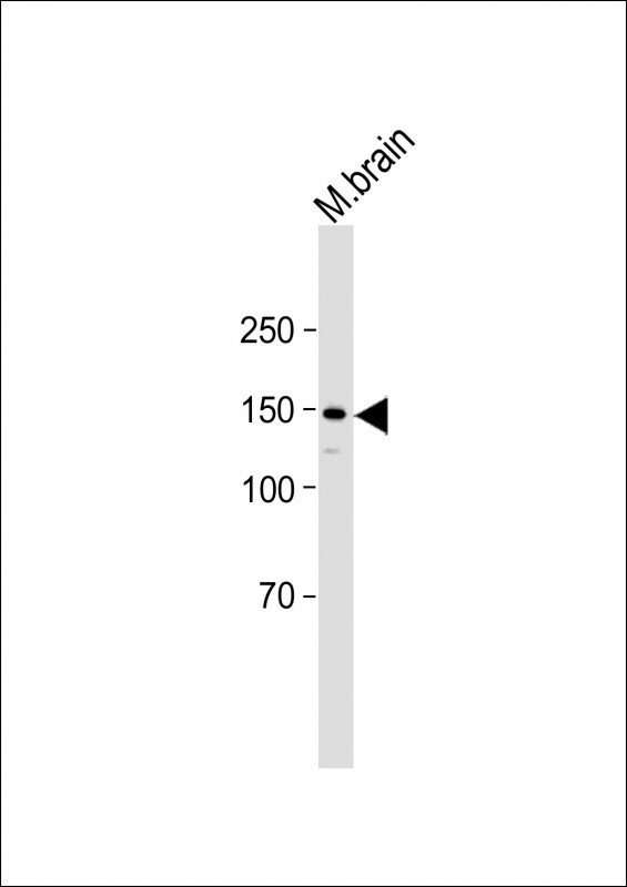1 - PITPNM2 Antibody (Center) AP13660c