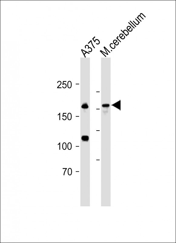 1 - CD109 Antibody (N-term) AP10639a