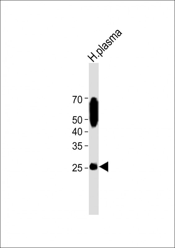 1 - VSTM2A Antibody (Center) AP11175c