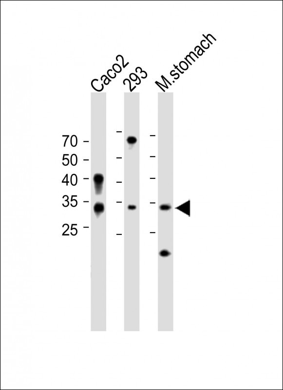 1 - VSTM2B Antibody (N-term) AP11415a