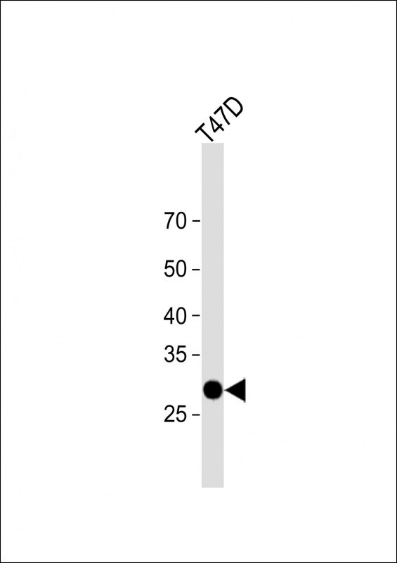 1 - TLCD1 Antibody (C-term) AP16573b