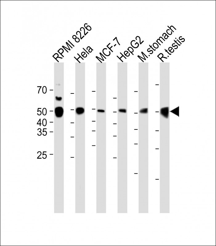 1 - GSDMA Antibody (N-term) AP4887a