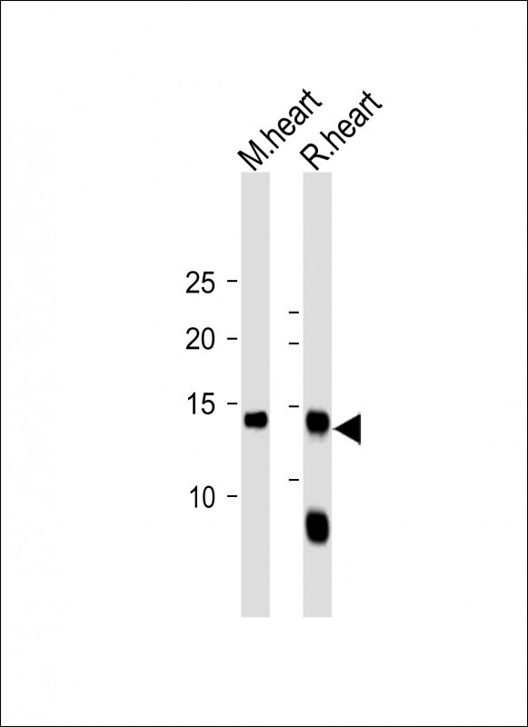 1 - FABP4 Antibody AM2235b
