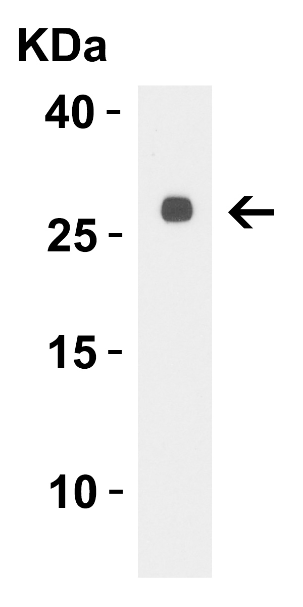 1 - LpxT Antibody ASC12237