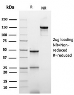 1 - Recombinant His Tag Antibody / Histidine [r6HIS/6423] ASC12236