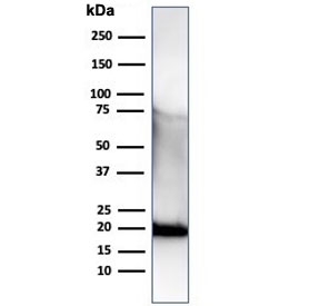 1 - Recombinant His Tag Antibody / Histidine [r6HIS/6423] ASC12236