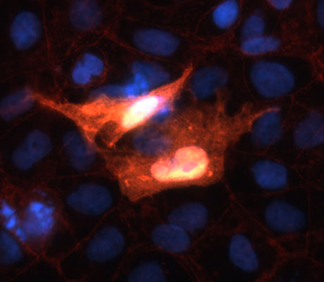 2 - Anti-beta Catenin Antibody AN1322