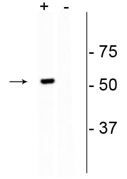 1 - Anti-CRISPR Cas9 Antibody AN1349